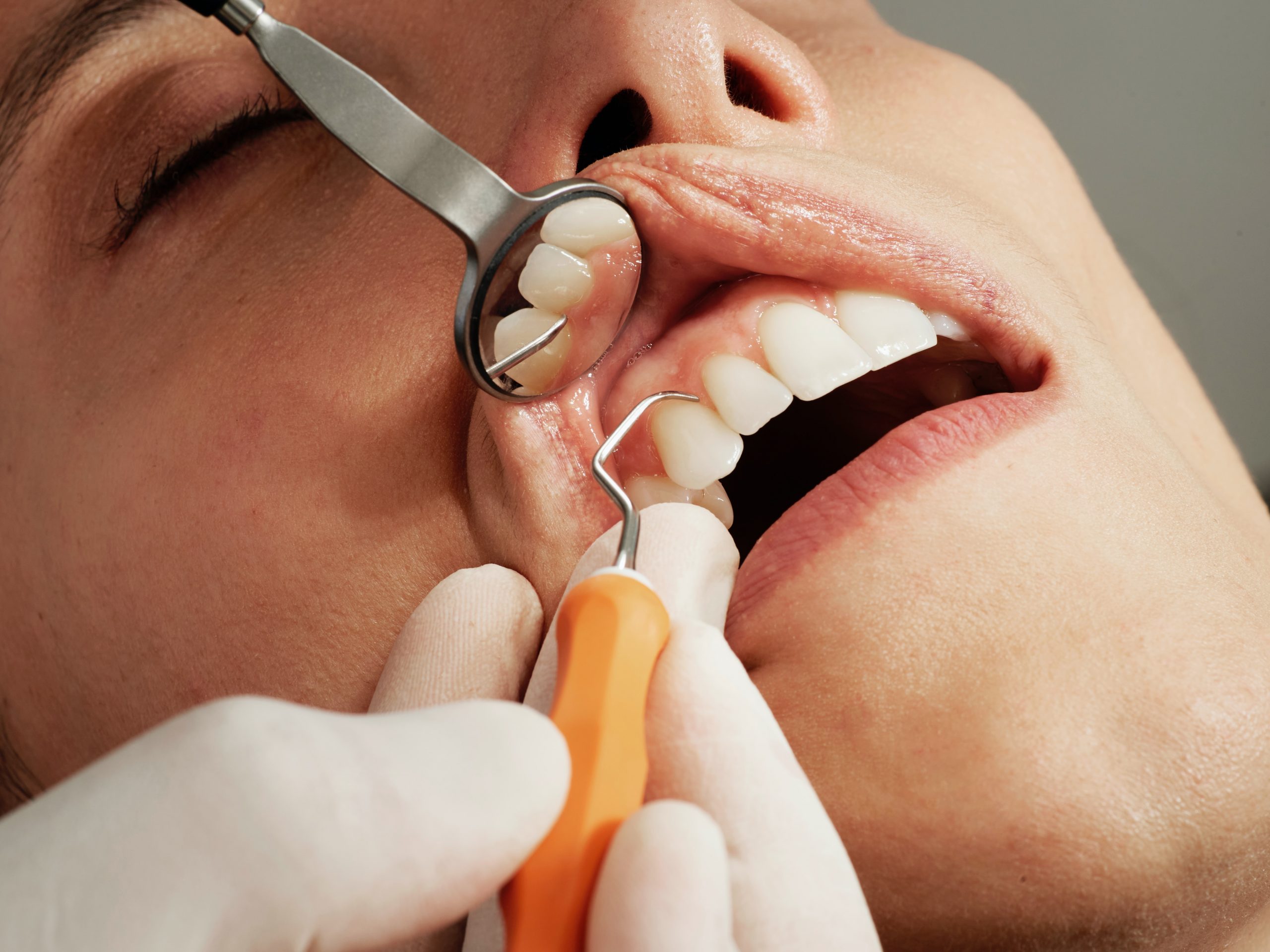 sensitive teeth