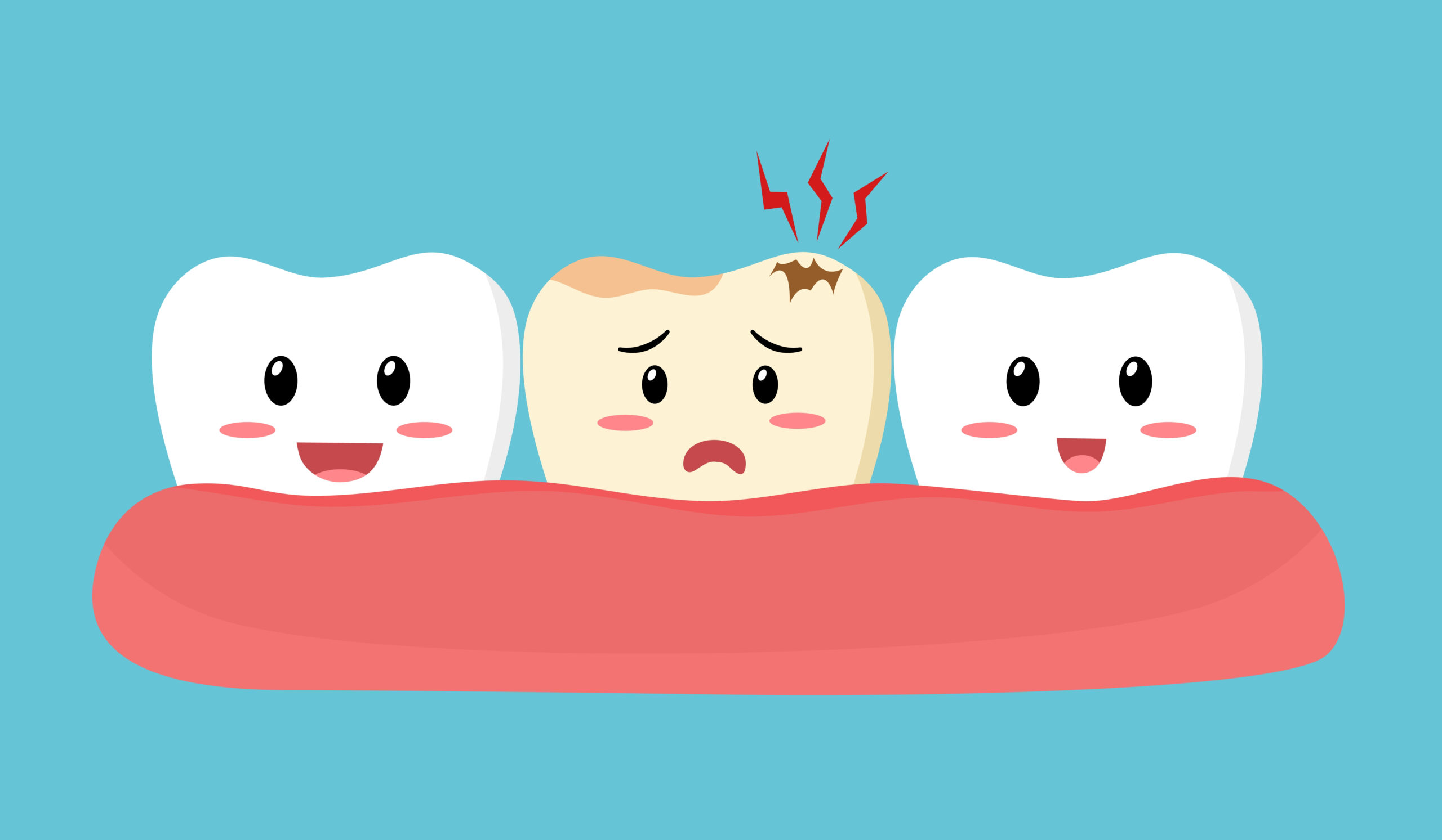 Dental,Cavity,Concept..,Smiling,Healthy,Teeth,With,Sad,Decay,Tooth