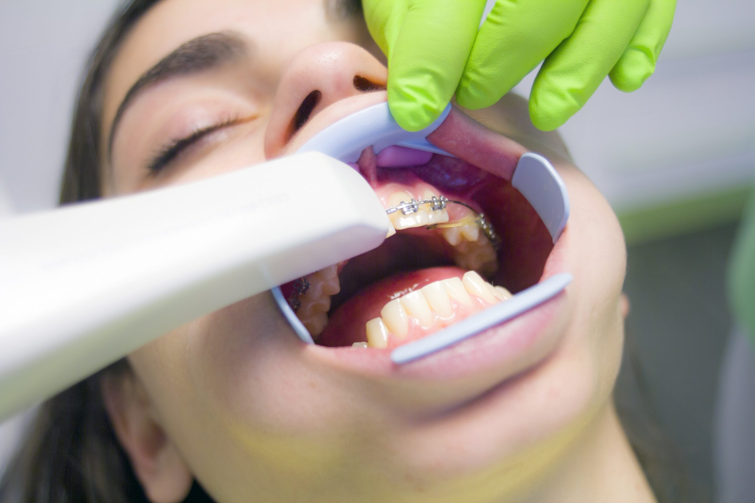 patient is receiving an Oral Hygiene treatment